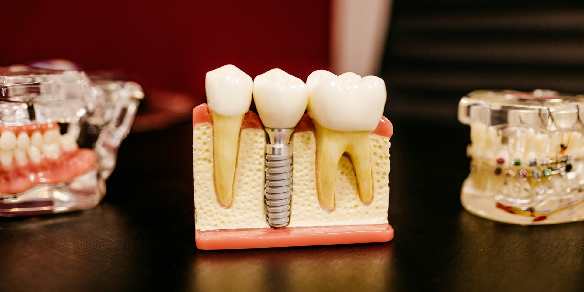 Nurturing Oral Health: The Importance of Regular Dental Visits