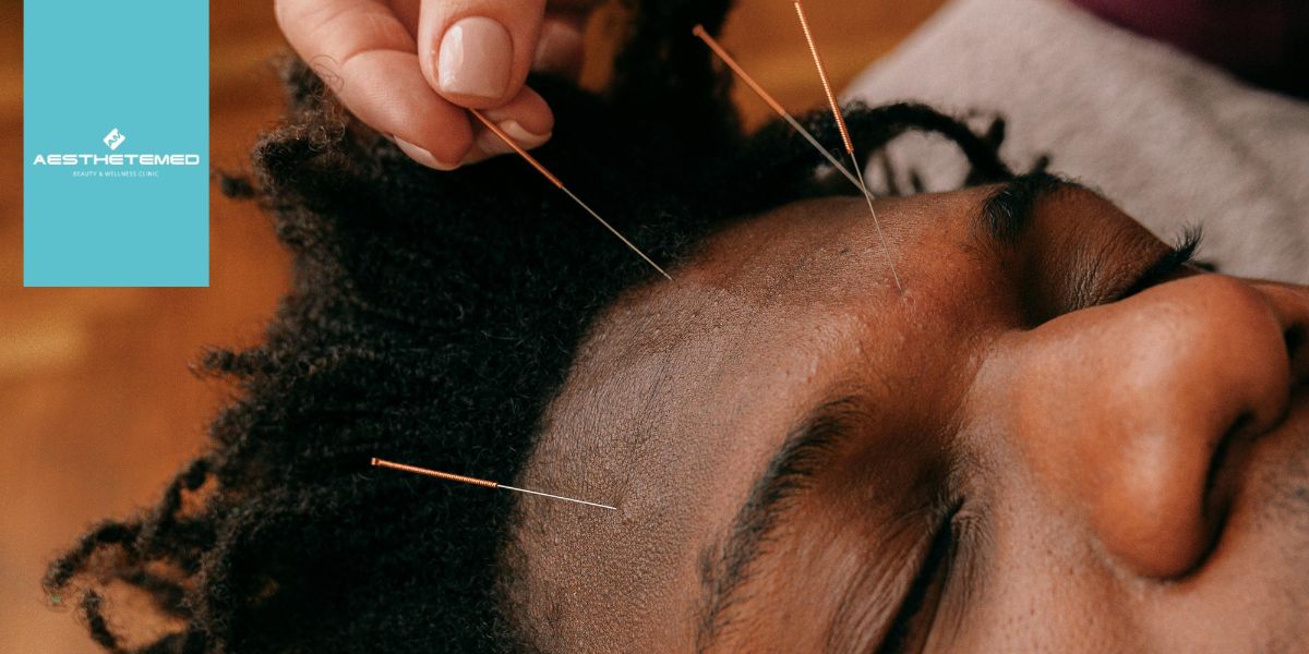Acupuncture in Miami: Science, Philosophy, and Effective Therapy at AestheteMed