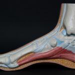Non-Surgical Plantar Fasciitis Care in Hollywood, Florida